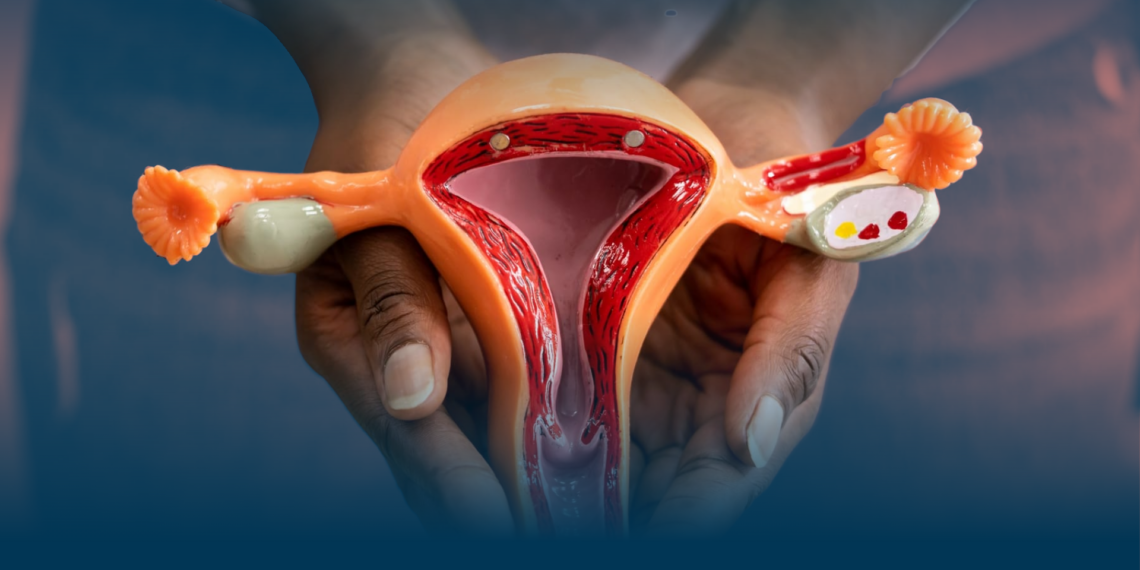 What is cervical cancer, the fourth most common in women? 
